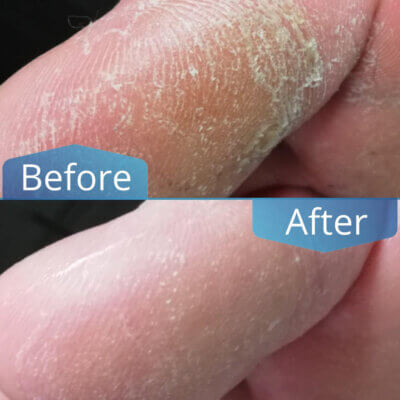 FOOTBALM SOFT 150ml - Image 3