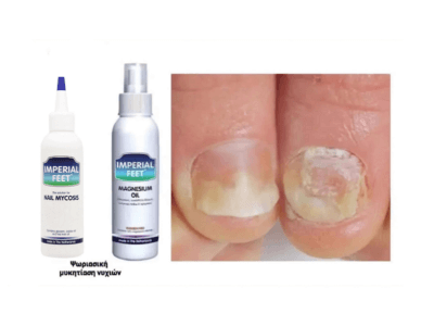 MAGNESIUM OIL 150ml - Image 4