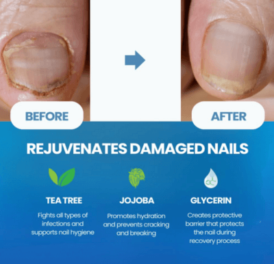 NAIL HEALTH 20ml - Image 2