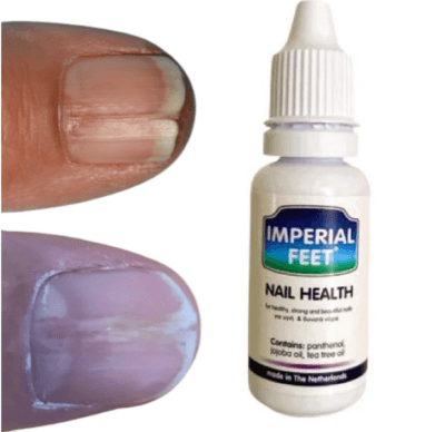 NAIL HEALTH 20ml - Image 3
