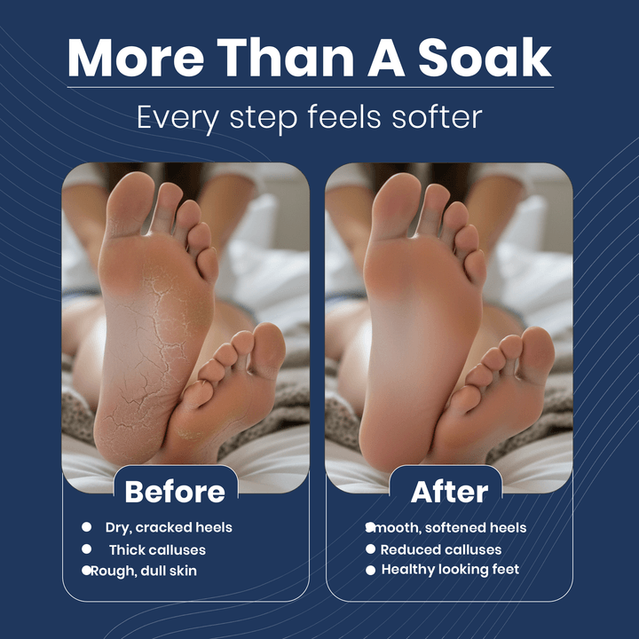 CRACKS & CALLUS FOOT SOAK - ΑΛΑΤΑ ΠΟΔΟΛΟΥΤΡΟΥ ΓΙΑ ΚΑΛΟΥΣ & ΣΚΛΗΡΥΝΣΕΙΣ cabin size XL 450g. - Image 2